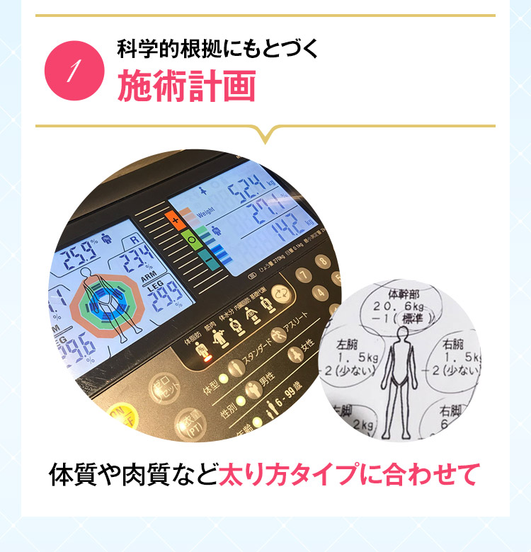 1 科学的根拠にもとづく施術計画　体質や肉質など太り方タイプに合わせて